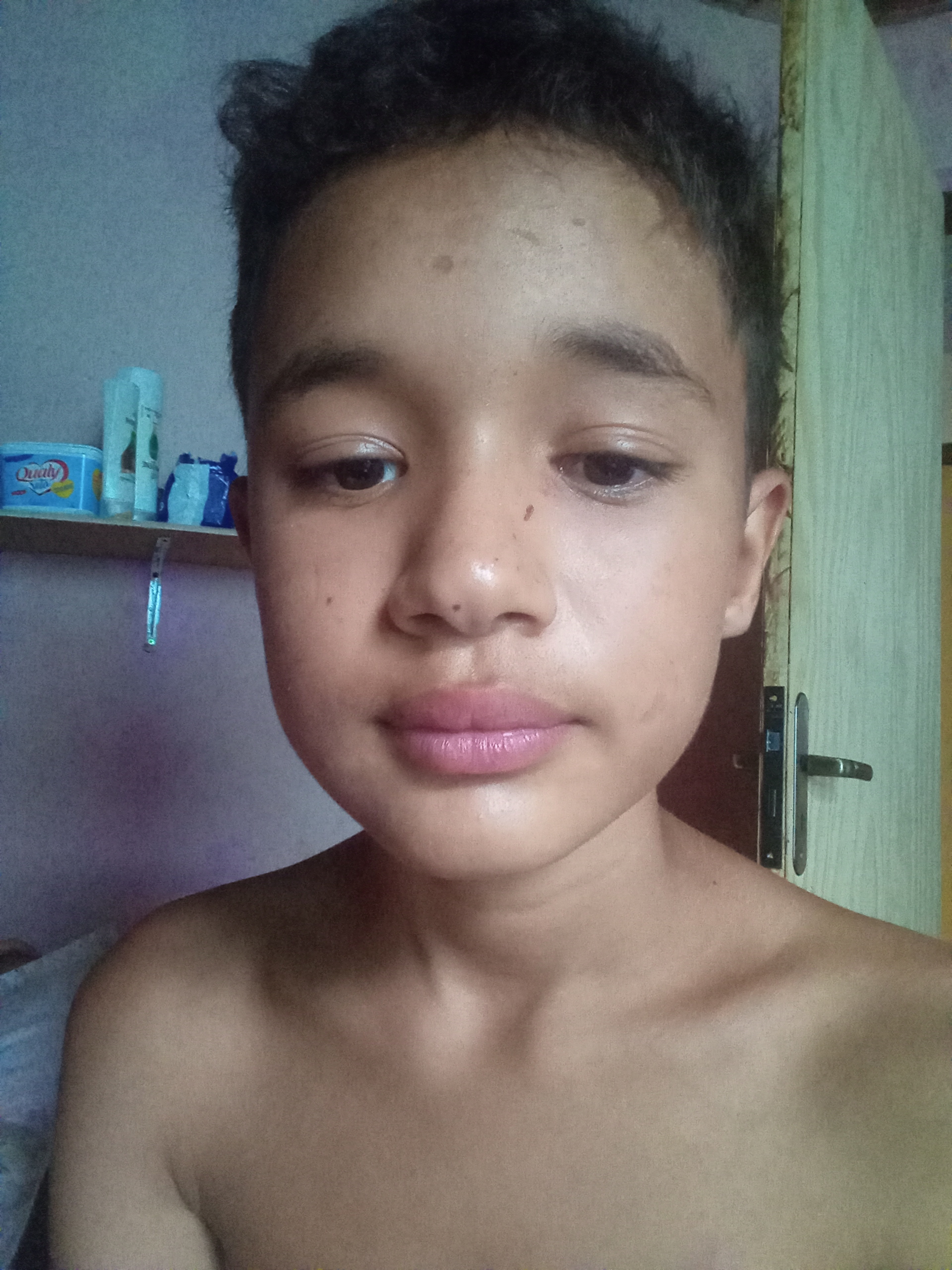 Bola pra Cima